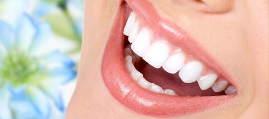 dentalveneer-aus-porzellan